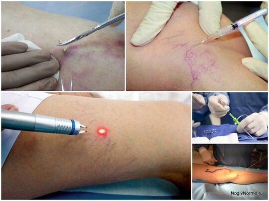 Arten der Behandlung