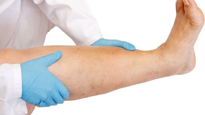 wie man die Krankheit erkennt